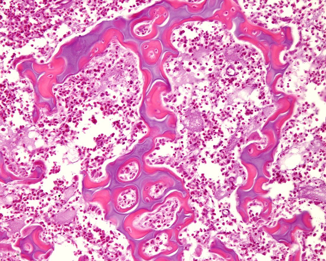 Mixed bone trabeculae, light micrograph