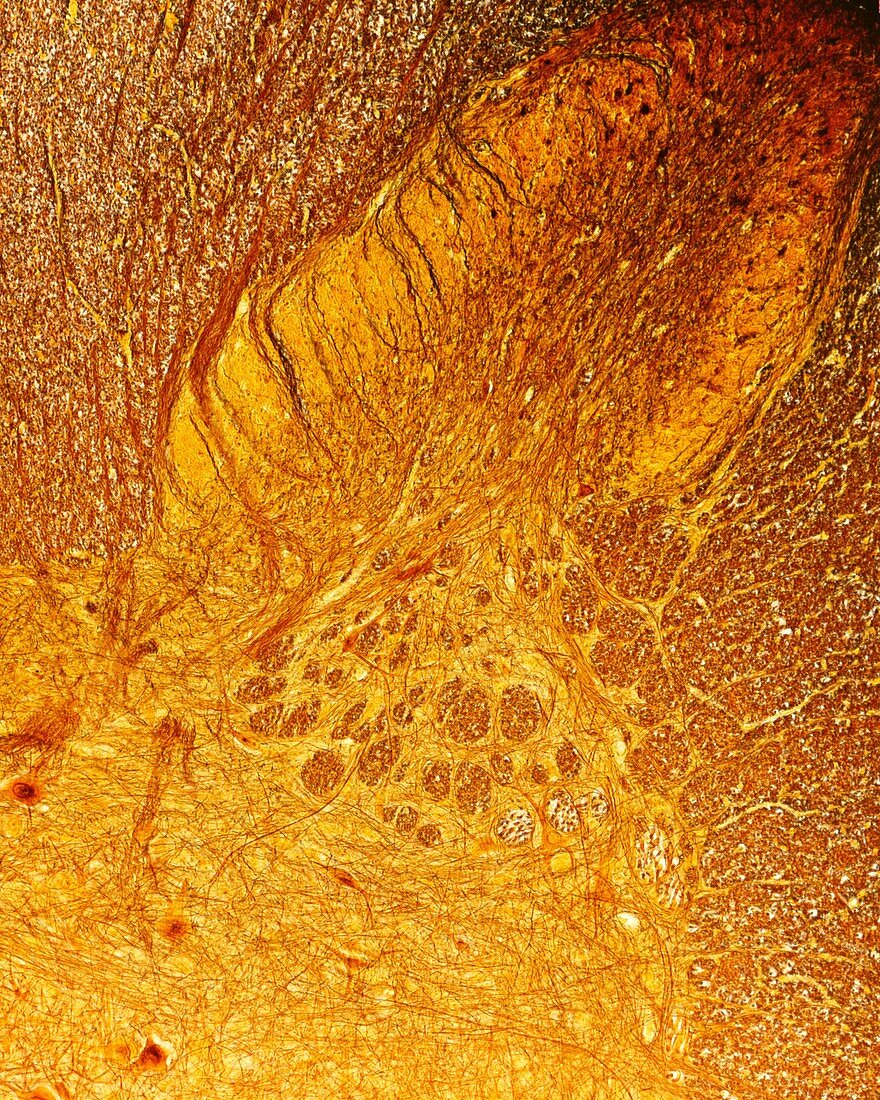 Spinal cord posterior horn, light micrograph