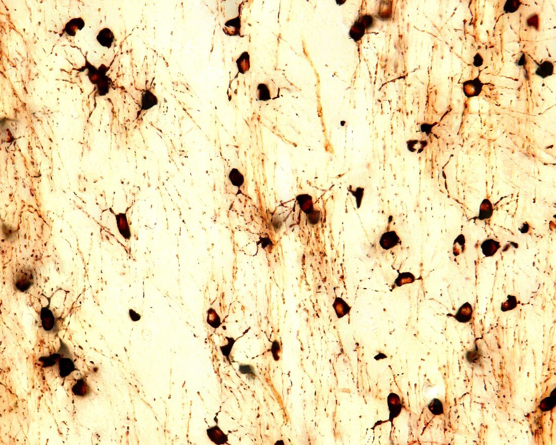 Oligodendroglia, light micrograph