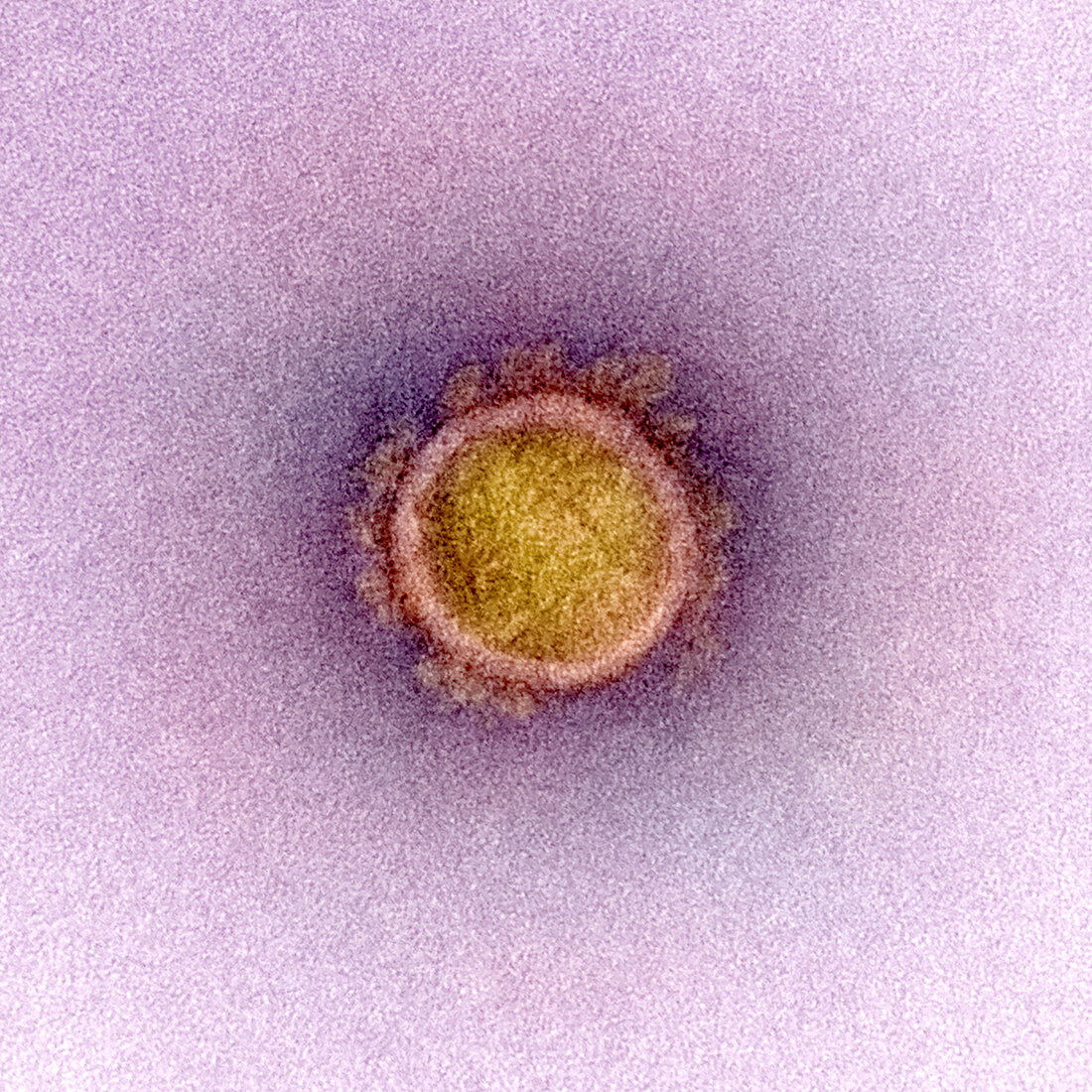 Covid-19 coronavirus virus particle, TEM