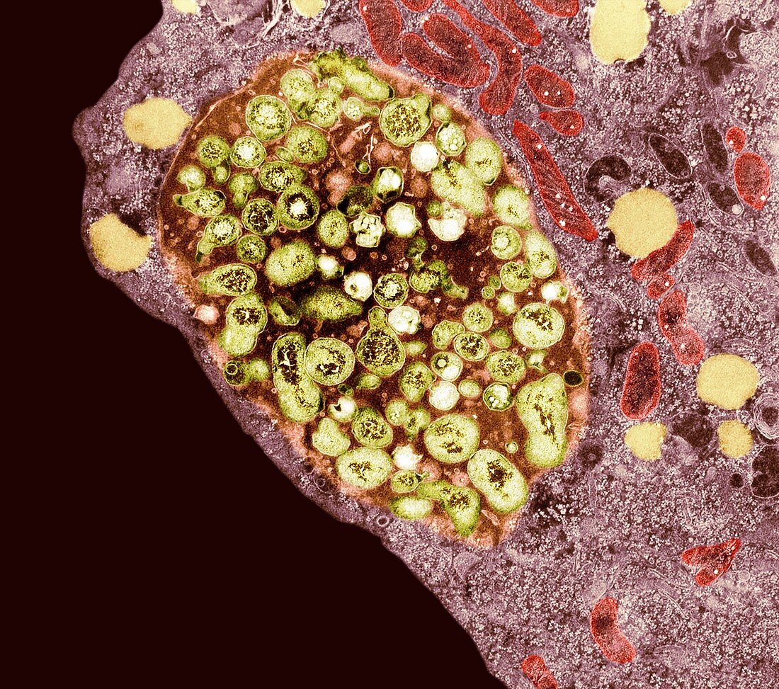 Chlamydia bacteria in a lung cell, TEM