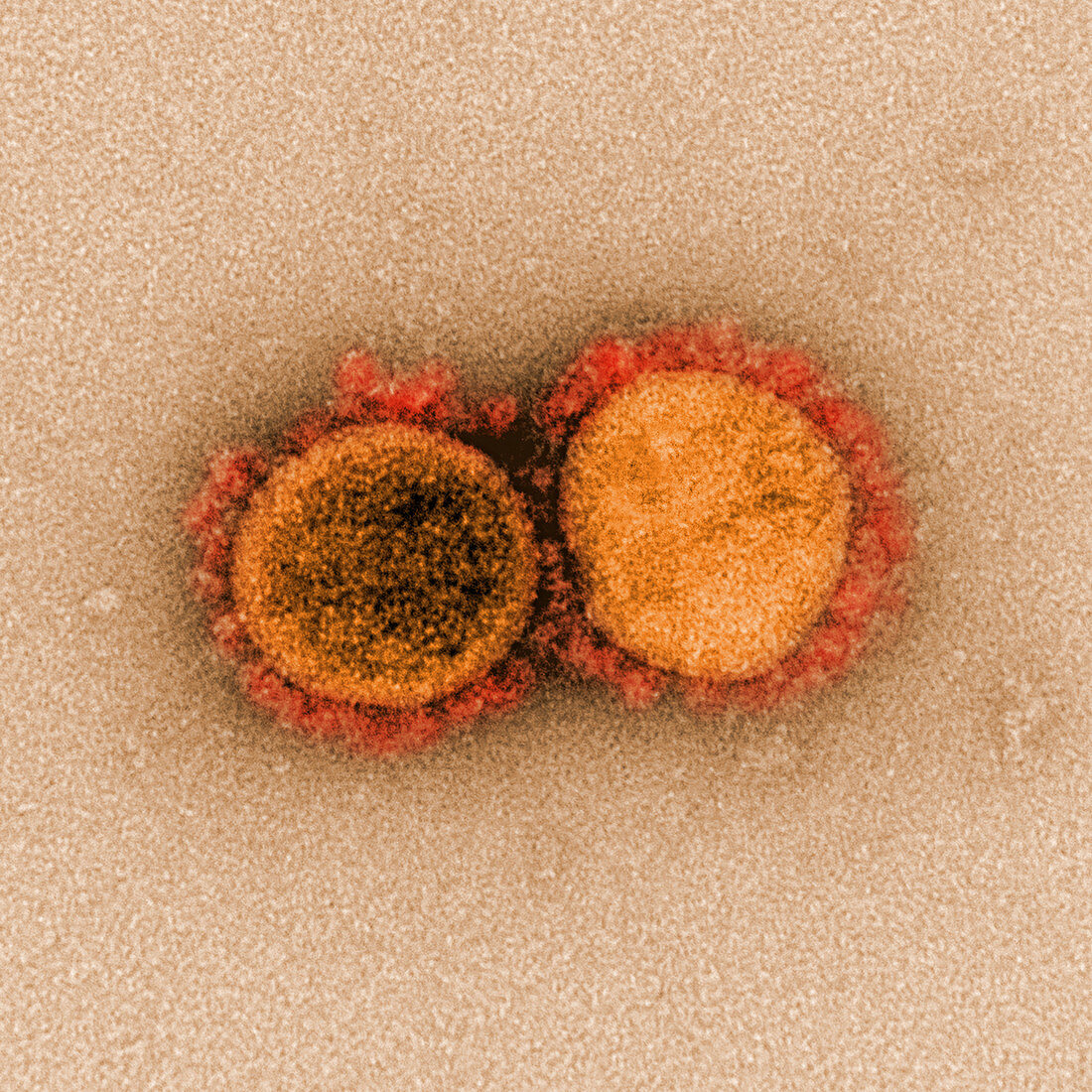 Covid-19 coronavirus, TEM