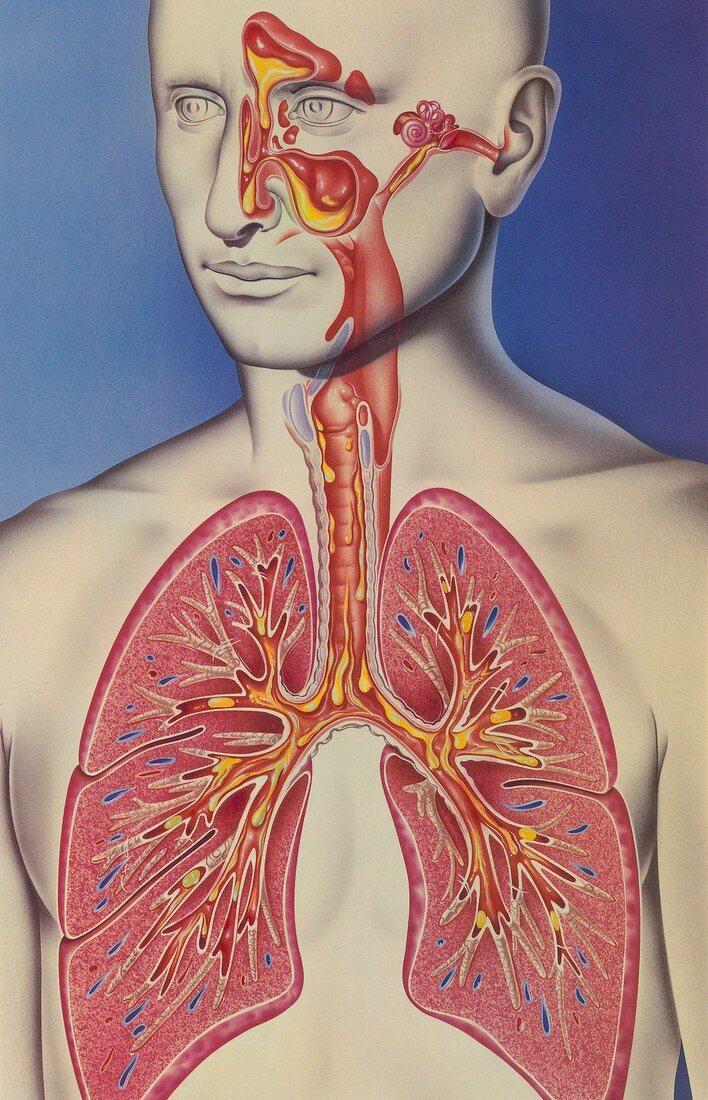 Upper and lower respiratory tract infections, illustration