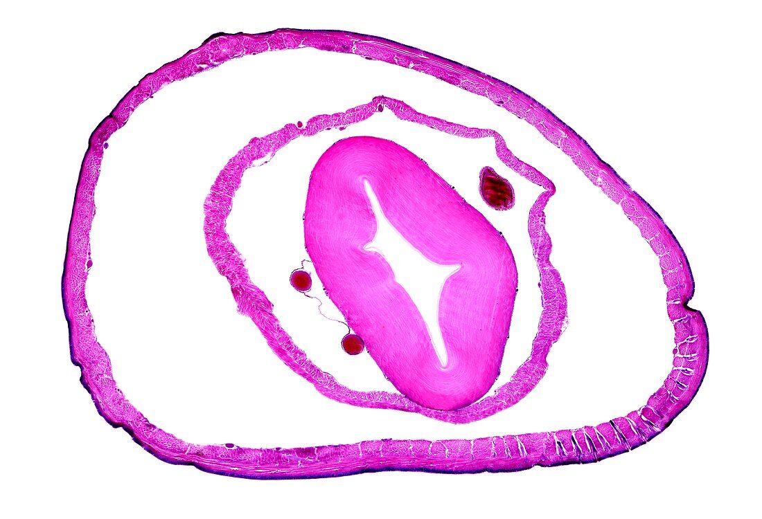 Earthworm heart region, light micrograph