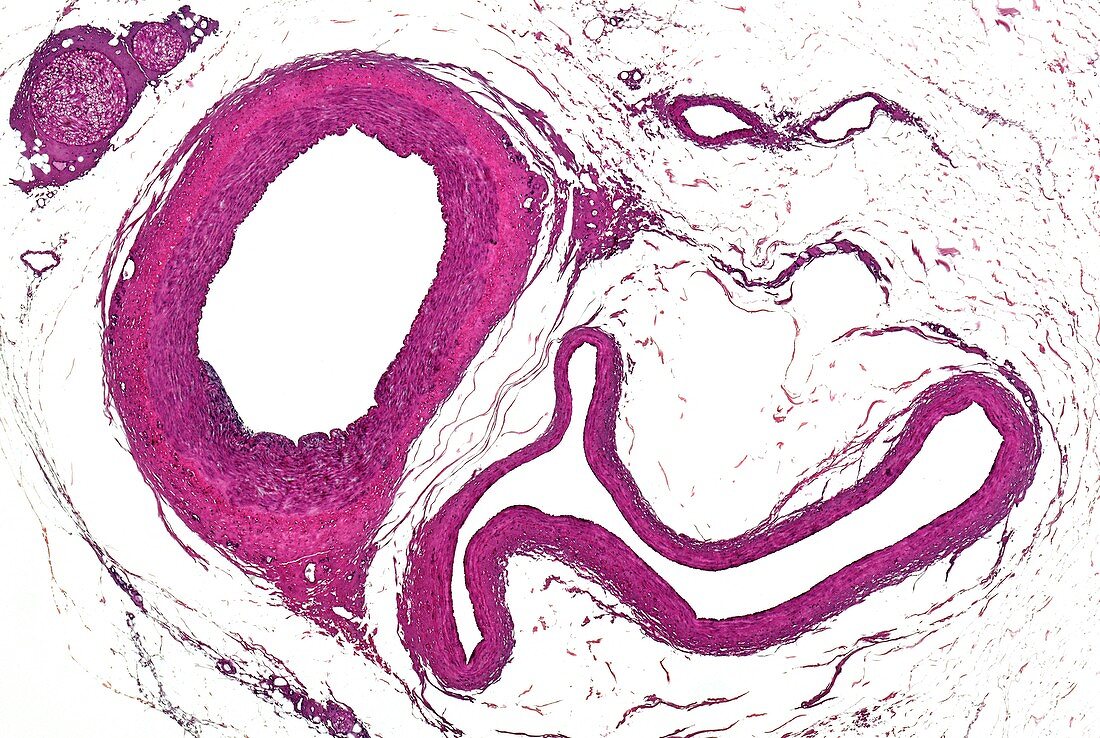 Mammal muscular artery, veins and nerves, light micrograph