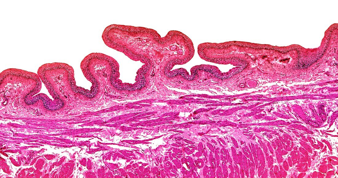 Urinary bladder transitional epithelium, light micrograph