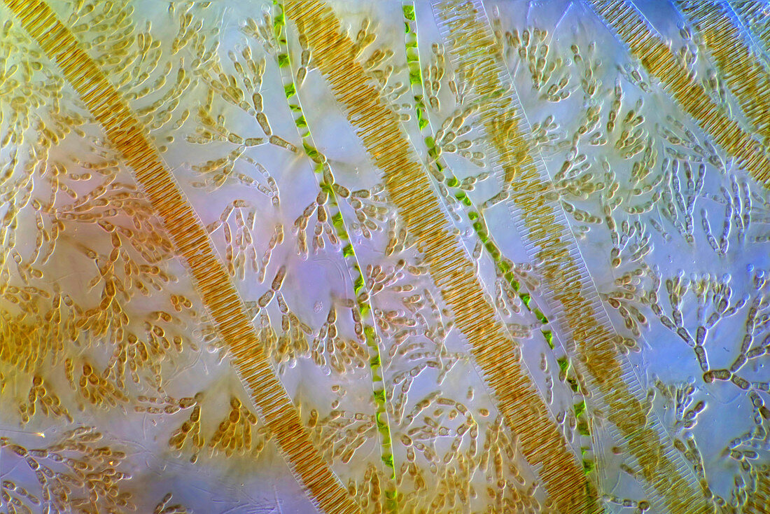 Batrachospermum cells and Fragilaria diatoms, micrograph