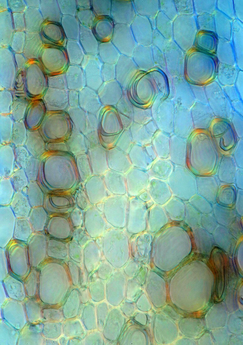 Broccoli, polarised light micrograph