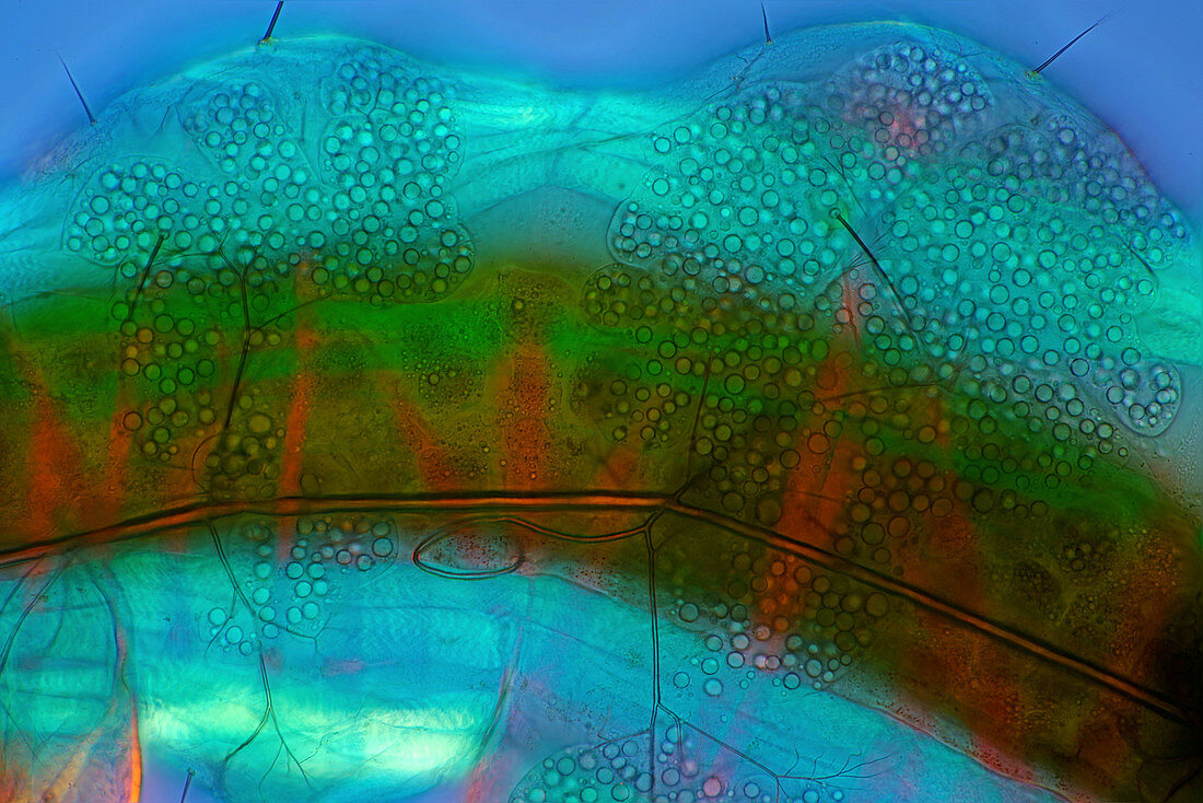 Caddisfly larva body, polarised light micrograph