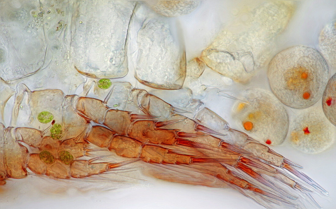 Legs and eggs of Cyclops copepod, micrograph