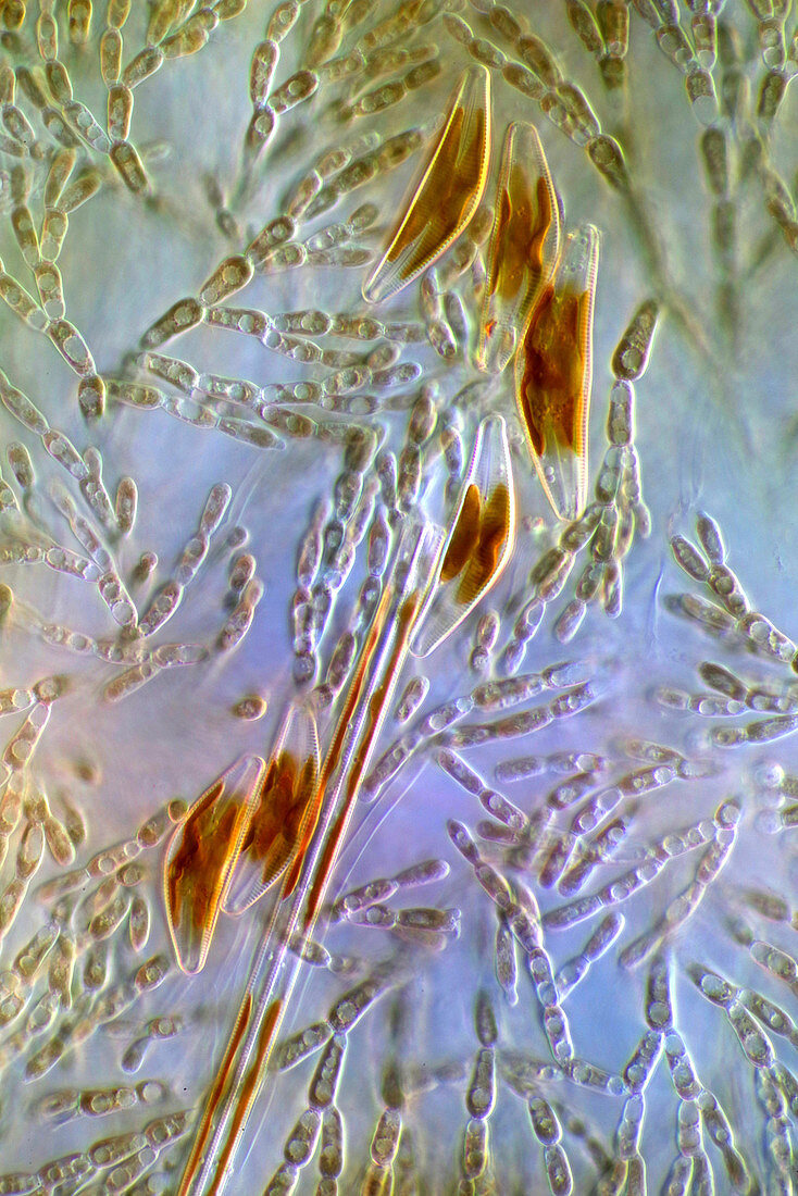 Red alga and diatoms, polarised light micrograph