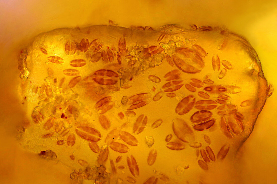 Diatoms on the surface of a sand grain, light micrograph