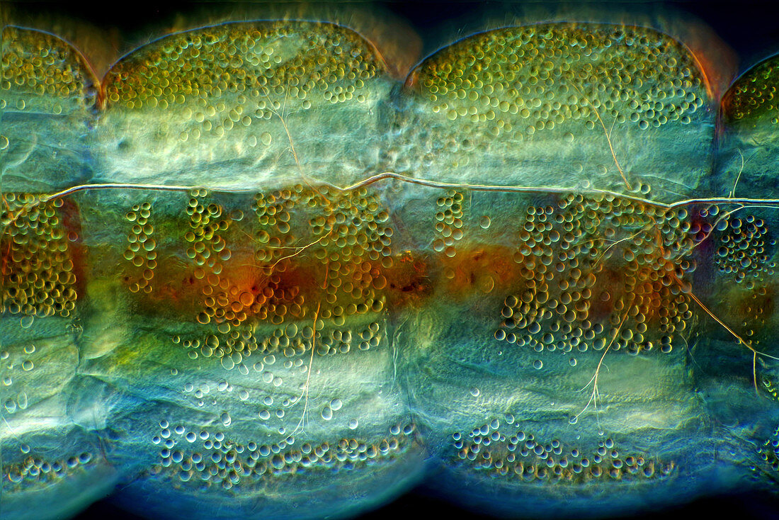 Diptera larva body, light micrograph