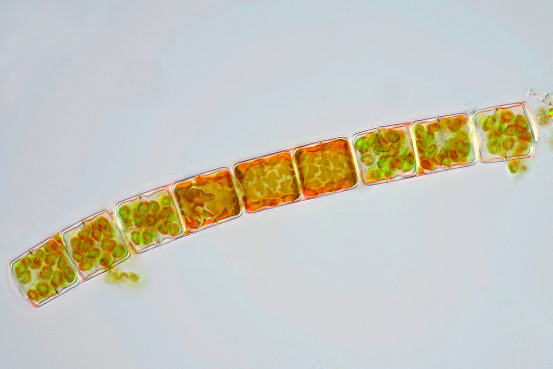 Melosira diatoms, light micrograph