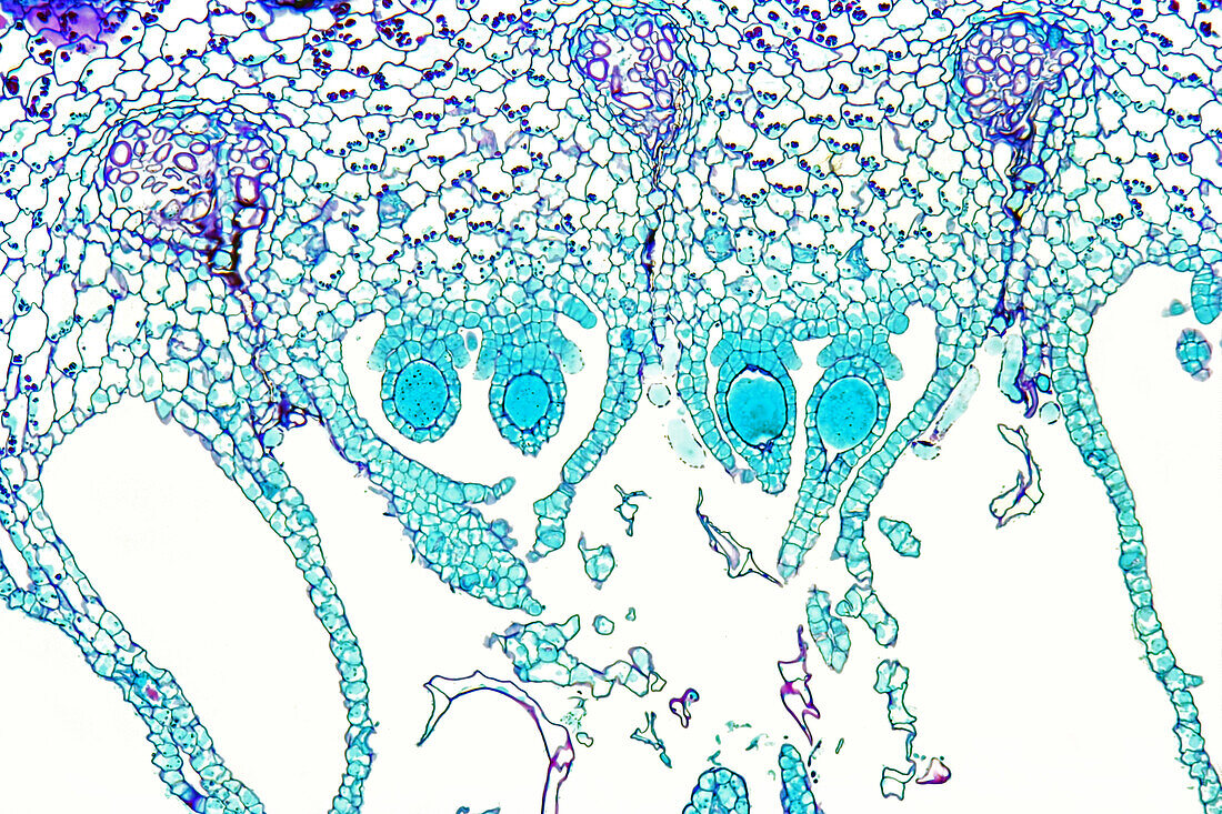 Liverwort female sex organs, light micrograph
