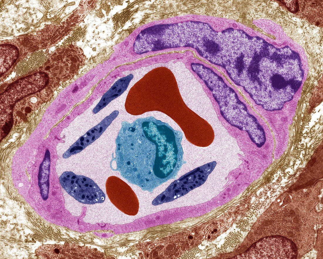 Capillary and blood cells, TEM