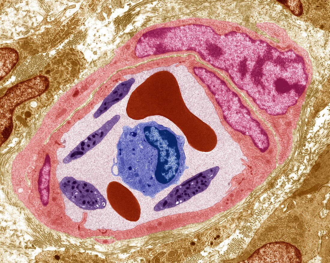 Capillary and blood cells, TEM