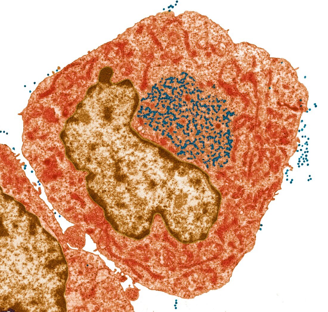 Hybridoma cells, TEM