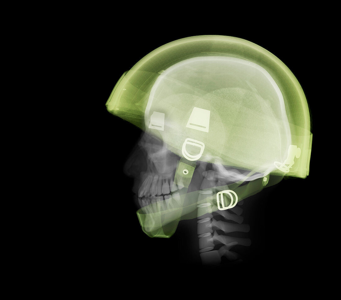 Skull wearing helmet, X-ray