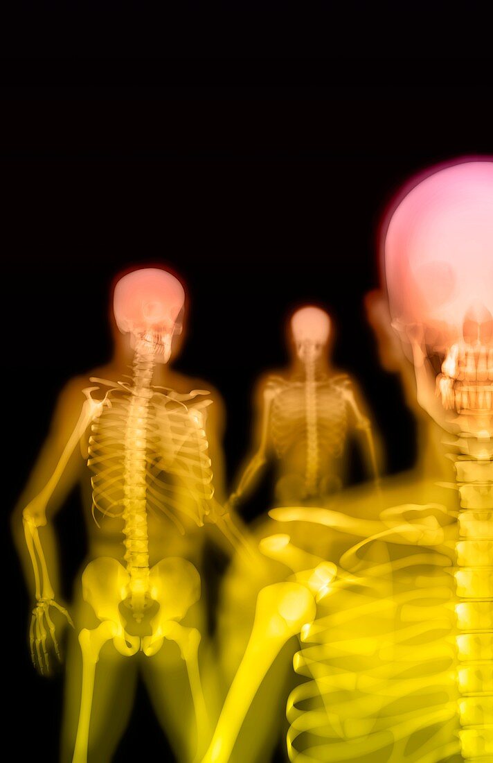 Group of skeletons, X-ray