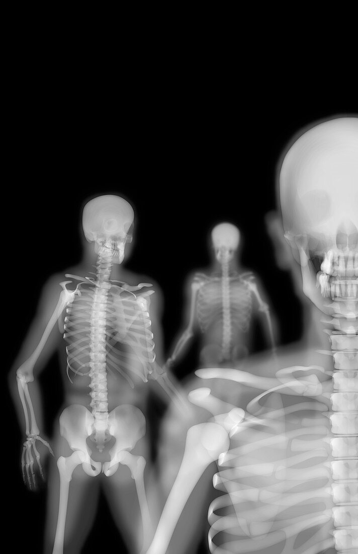 Group of skeletons, X-ray