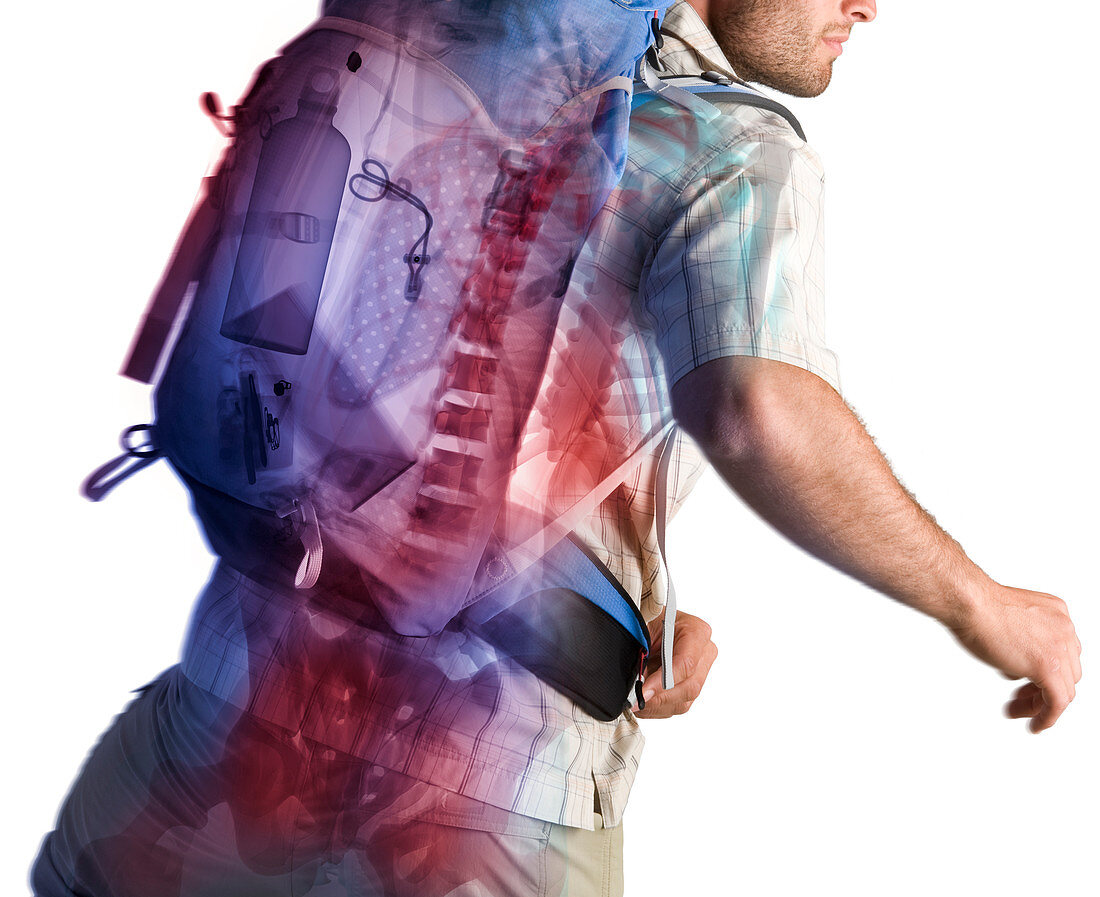 Man wearing rucksack, X-ray