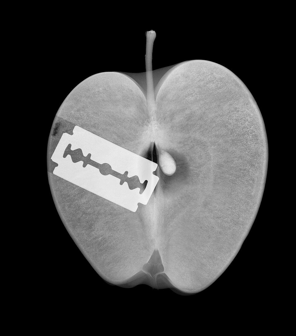 Razor blade hidden in apple, X-ray