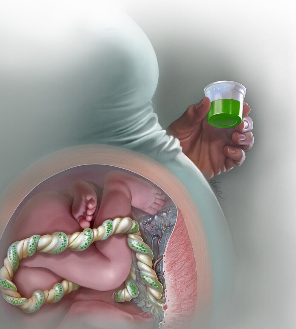 Medication Assisted Withdrawal, Illustration