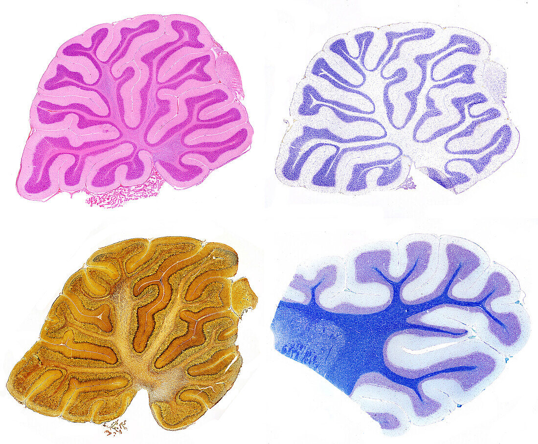 Cerebellum, Four Staining Techniques, LM