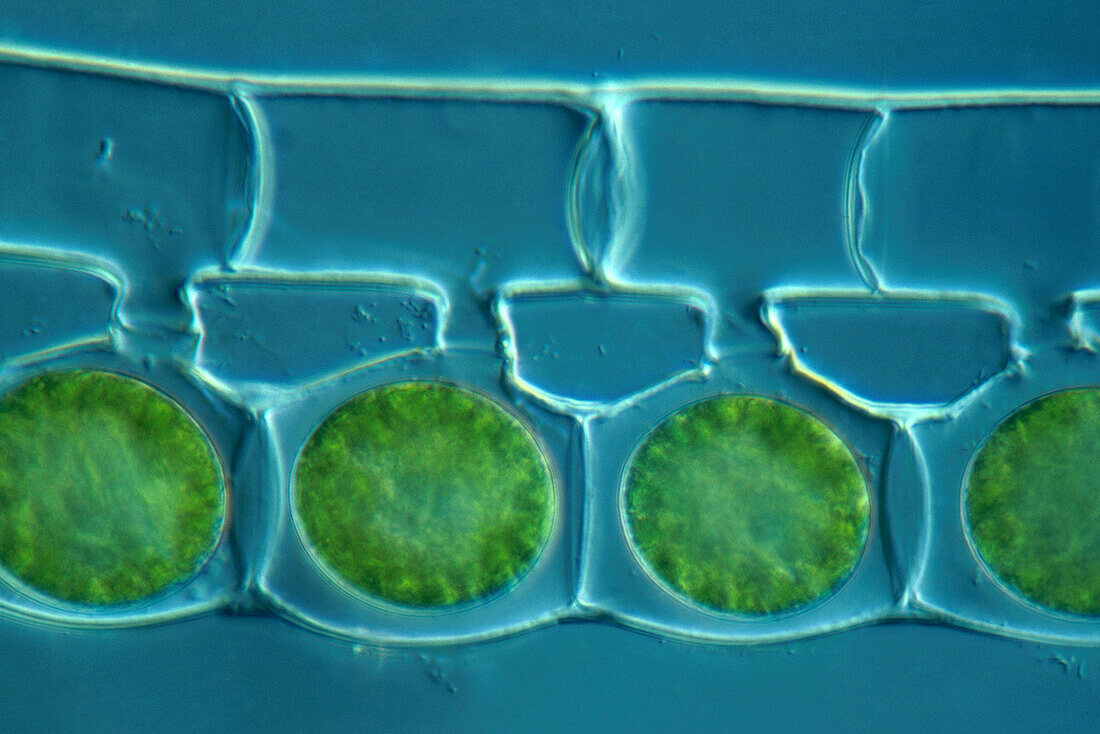 Conjugation in Algae, 4 of 4