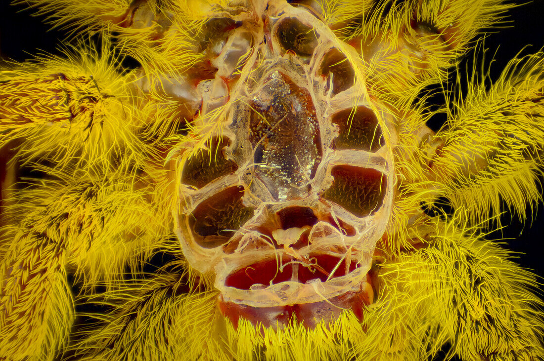 Sternum of Cephalothorax from a Jumping Spider