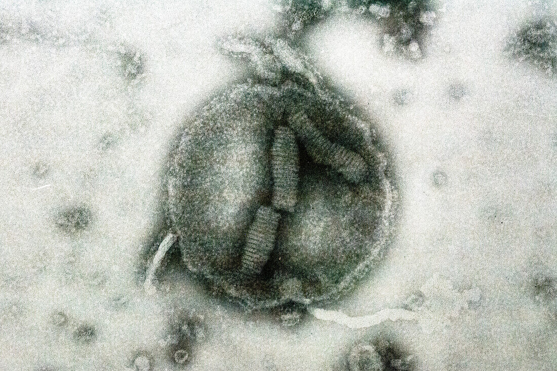 Influenza B Virus, TEM