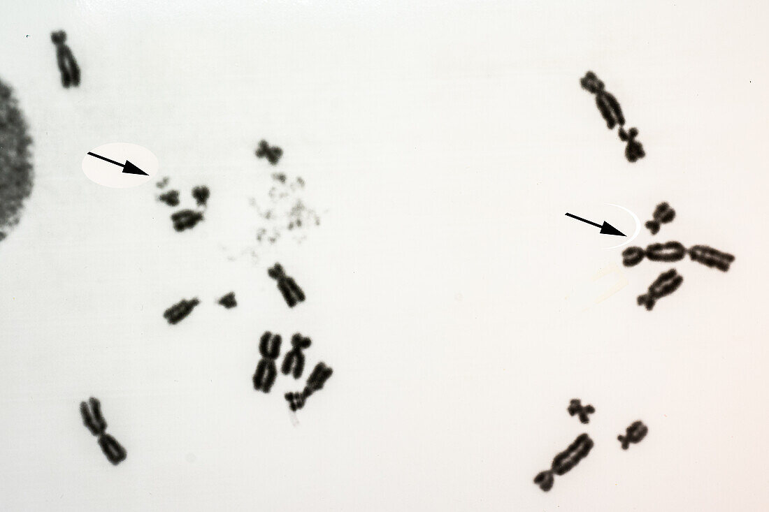 Human Chromosome Fragments
