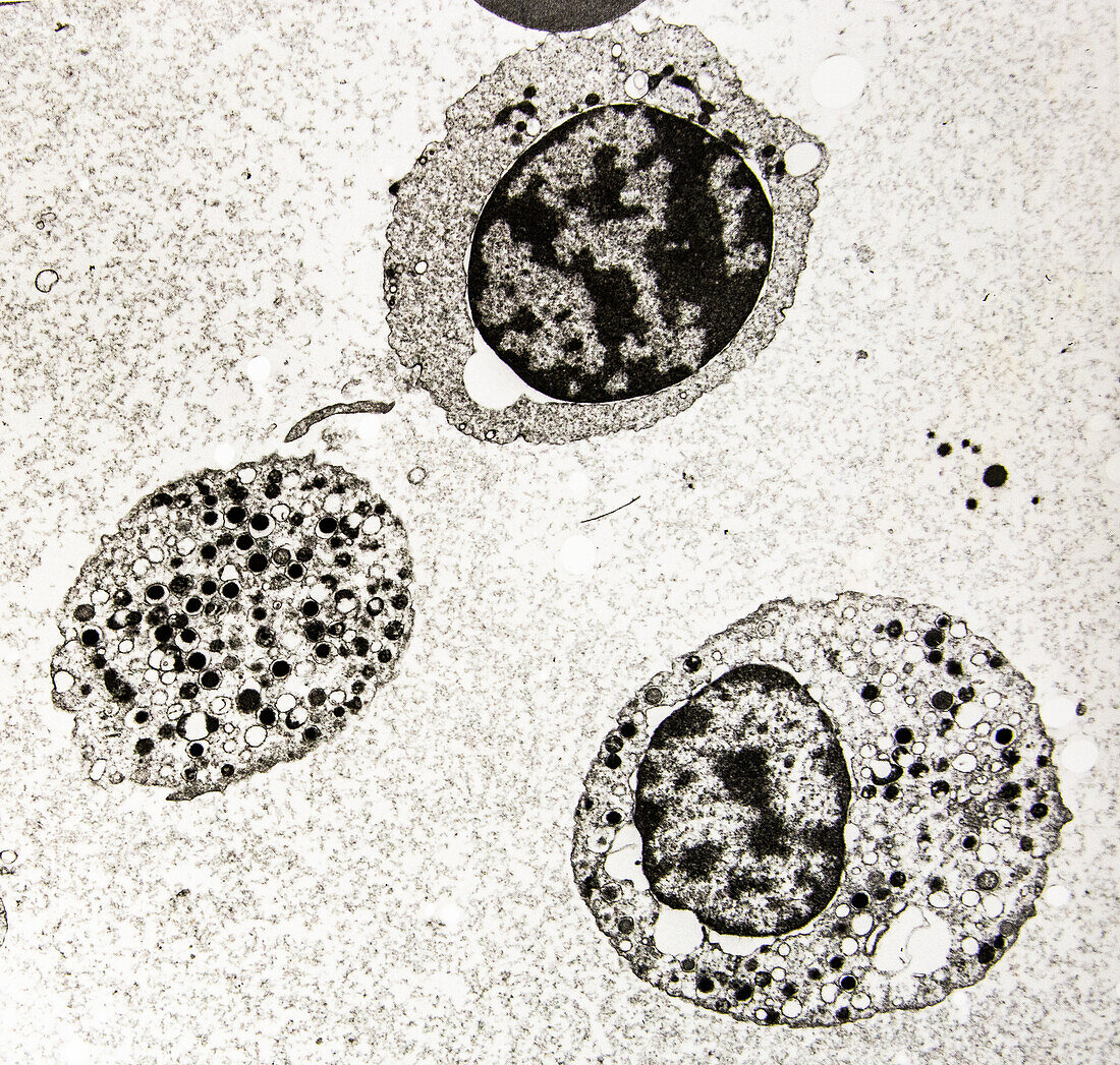 Megakaryocytes and Platelet, EM