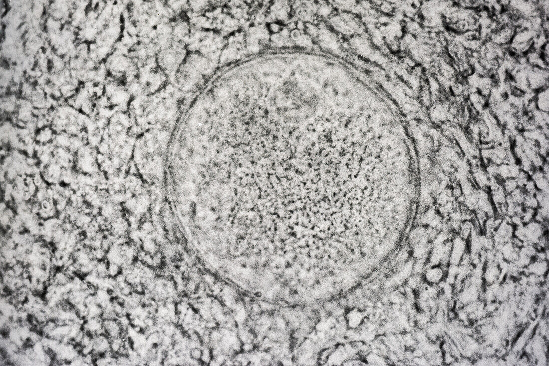 Human Egg Cell (Ovum), LM