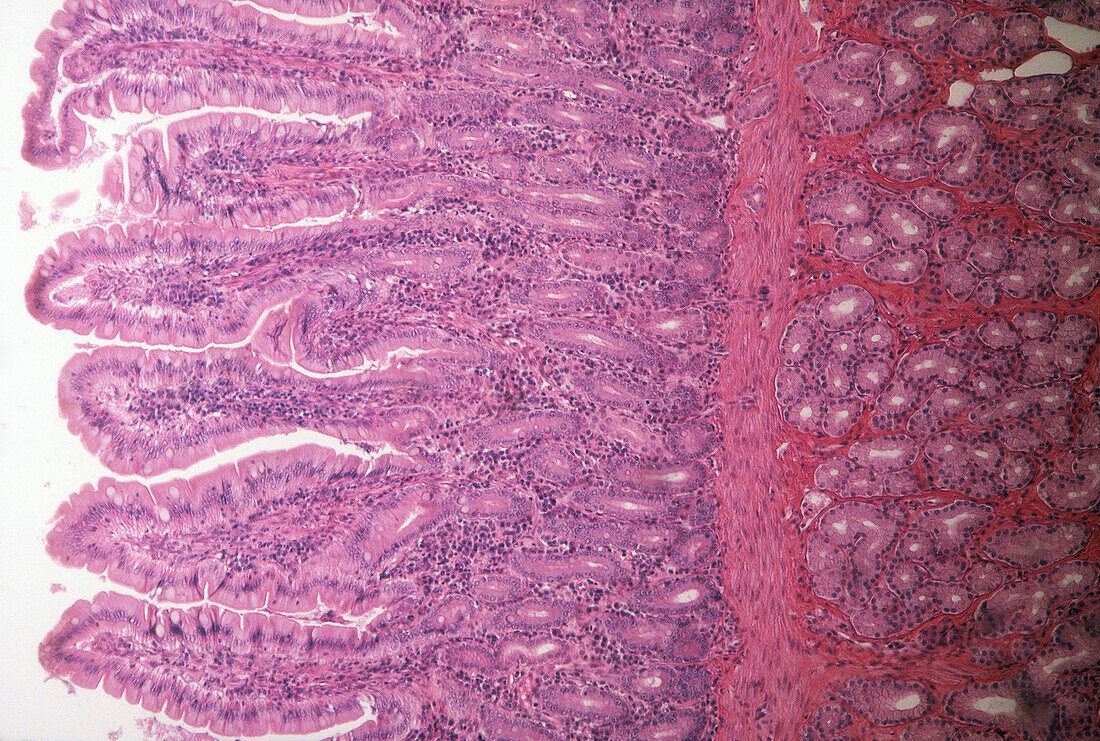 Small Intestine, LM