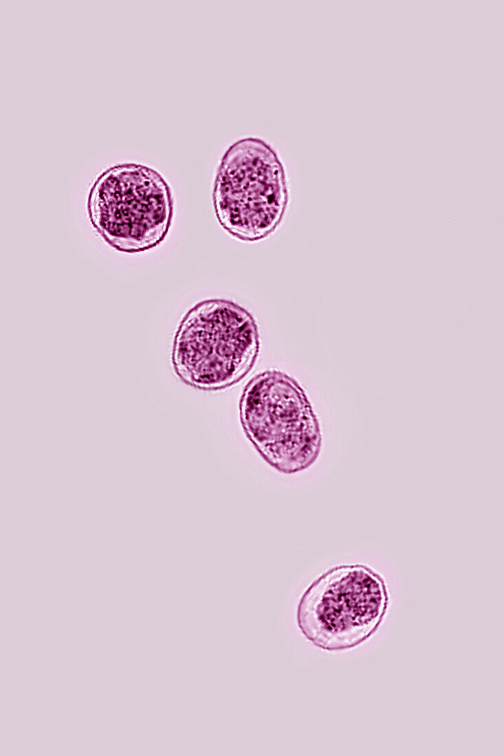 Brucella bacteria, LM