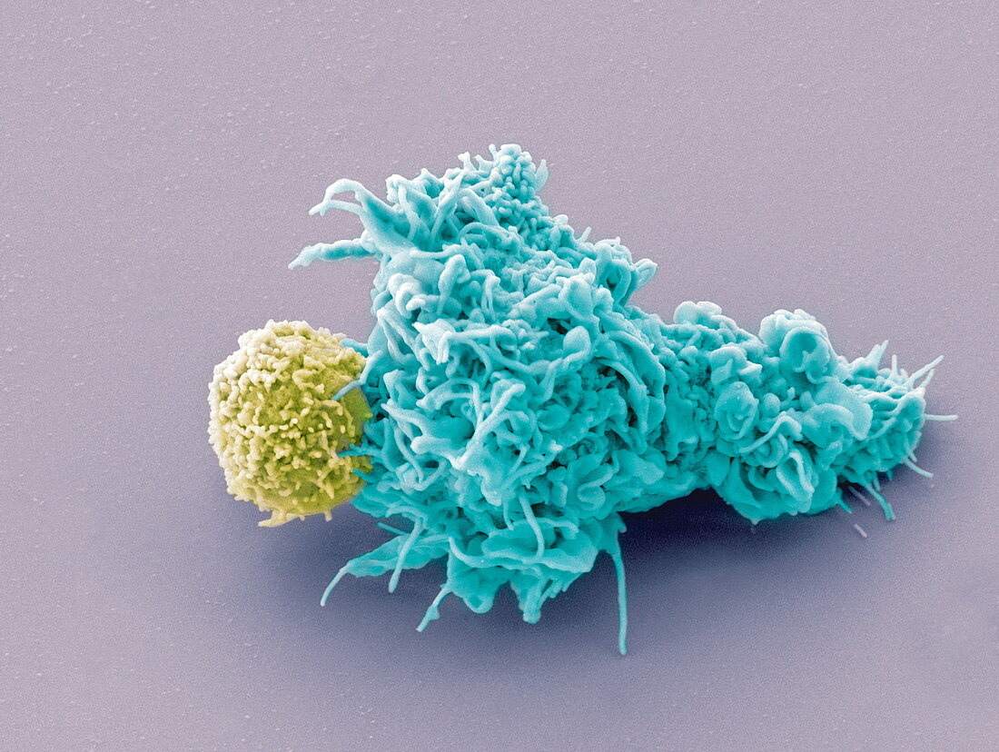 Dendritic cell and lymphocyte, SEM