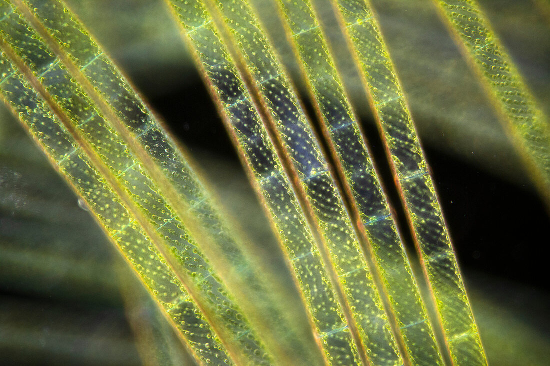 Spirogyra alga, polarised light micrograph