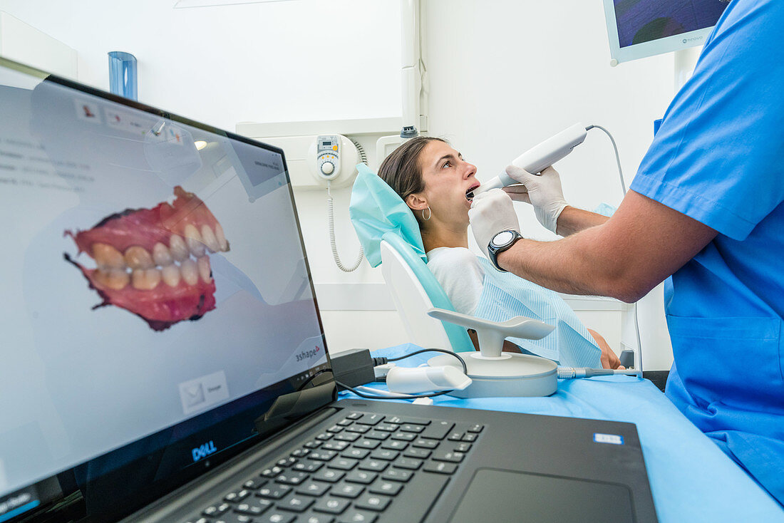Digital dental impression with intraoral camera