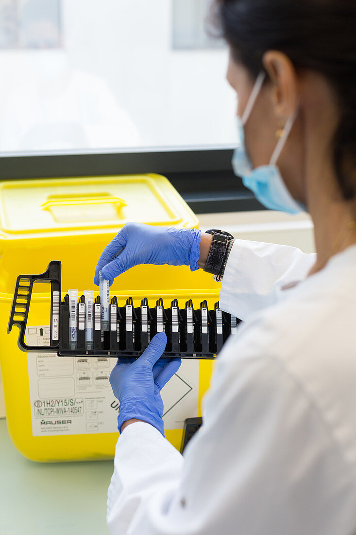Loading of the reagents of COVID-19 screening PCR test