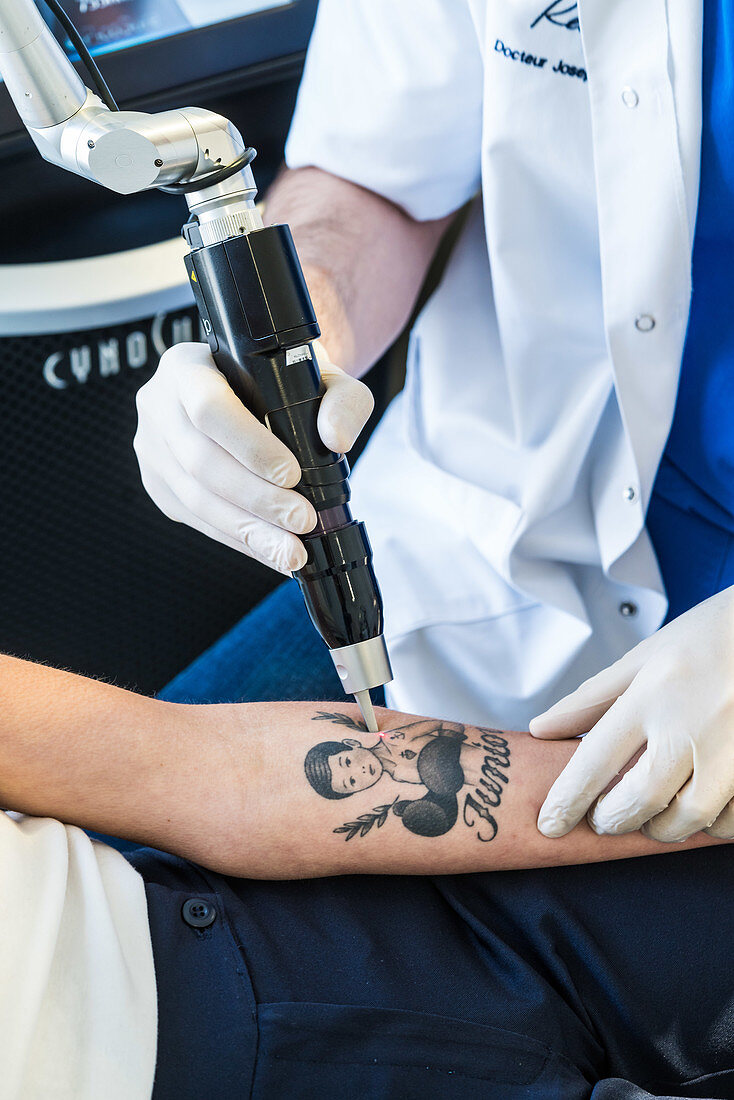 Picosecond laser used for tattoo removal