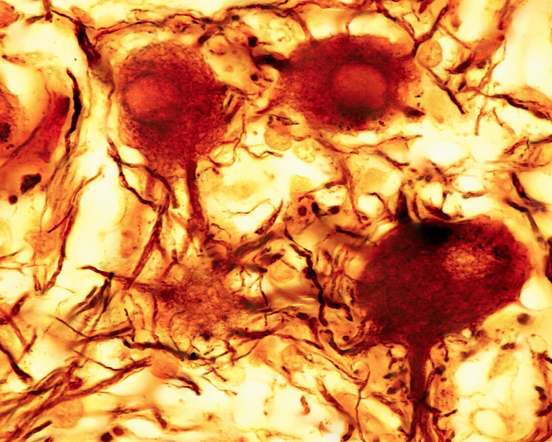 Sympathetic neurons, light micrograph