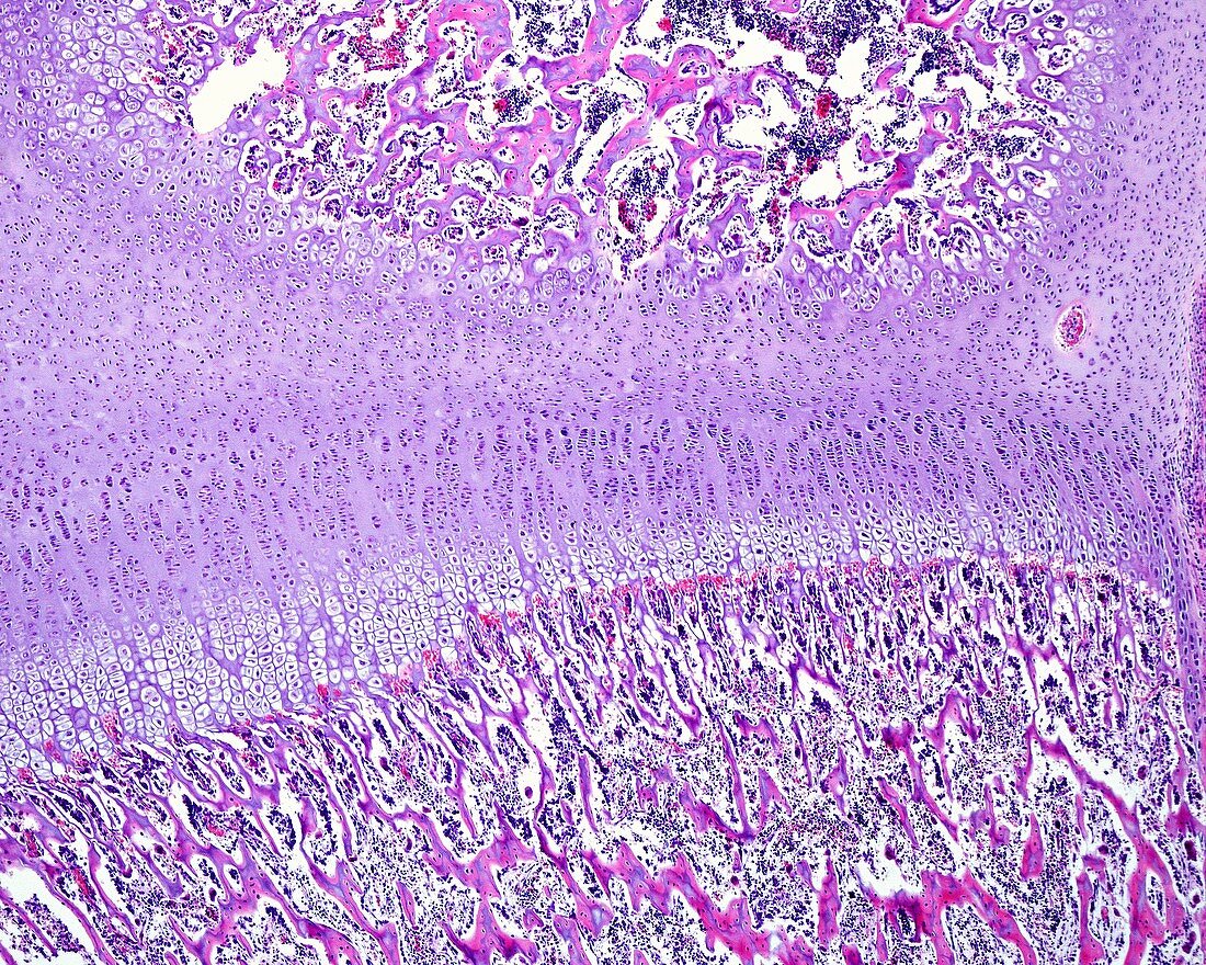 Endochondral ossification, light micrograph