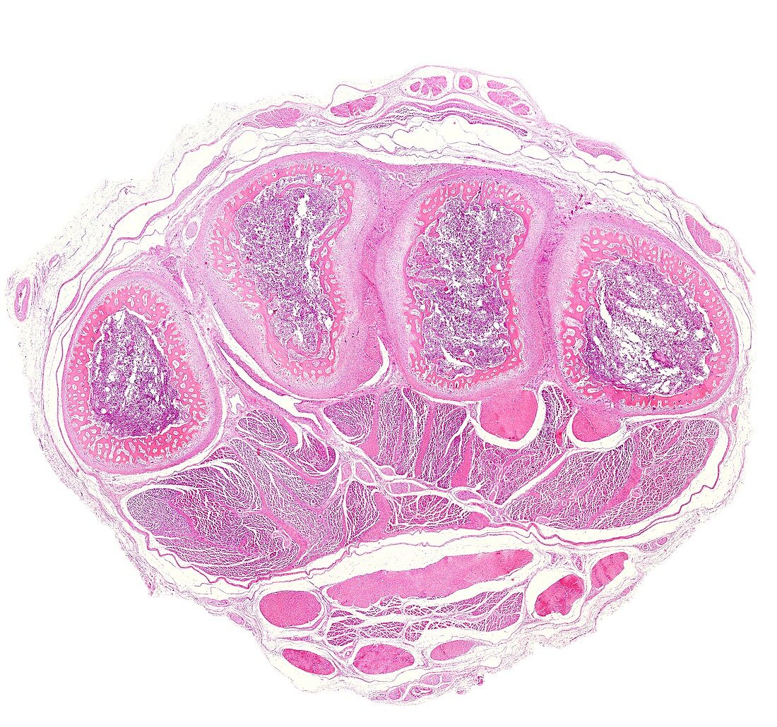 Embryo hand, light micrograph