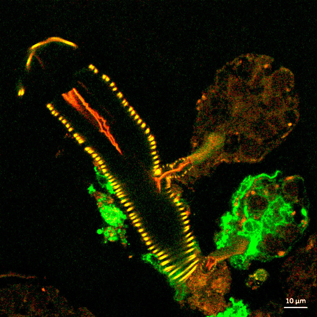Infected tick salivary gland, light micrograph