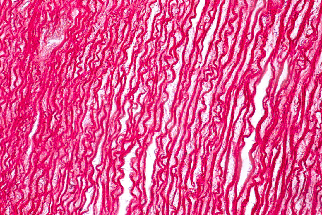 Human tendon, light micrograph