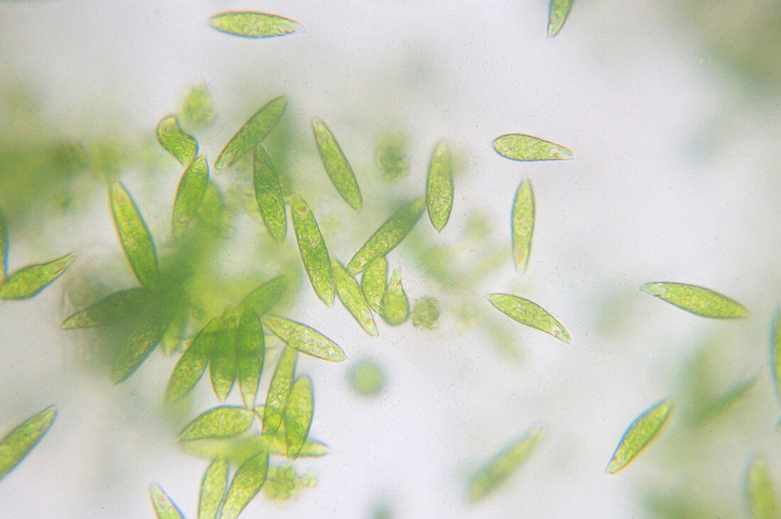 Euglena flagellate protozoans, light micrograph