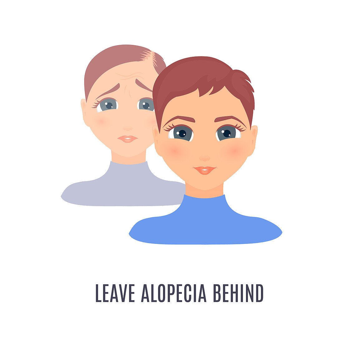 Female alopecia treatment, conceptual illustration