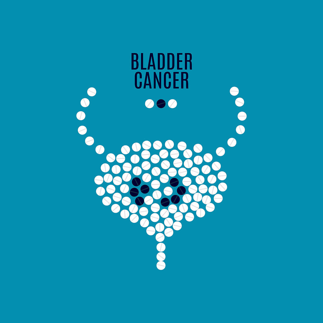 Bladder cancer, conceptual illustration